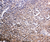 IHC-P: CXCR6 antibody testing of human tonsil tissue