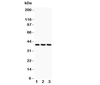 Western blot testing of CXCR6 antibody and Lane 1: HeLa; 2: Jurkat; 3: MCF-7 lysate. Expected/observed size ~39KD~