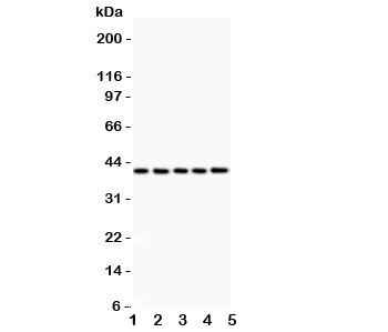Western blot testing of CXCR6 antibody and Lane 1: rat brain; 2: (r) testis; 3: (r) spleen; 4: mouse brain; 5: (m) testis; Expected/observed size ~39KD~