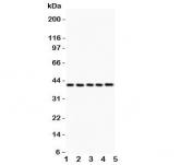 Western blot testing of CXCR6 antibody and Lane 1: rat brain;  2: (r) testis;  3: (r) spleen;  4: mouse brain;  5: (m) testis;  Expected/observed molecular weight: ~39kDa.