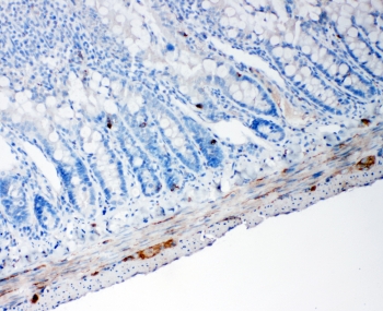 IHC staining of FFPE rat intestine tissue with Proprotein Convertase 1/3 antibody. HIER: boil tissue sections in pH6, 10mM citrate buffer, for 10-20 min and allow to cool before testing.