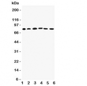 Western blot testing of Proprotein Convertase 1/3 antibody; Lane 1: rat liver;  2: (r) thymus; and human samples  3: A549;  4: HeLa;  5: COLO320;  6: PANC cell lysate