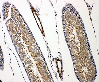 IHC-P: Prolactin Receptor antibody testing of rat testis tissue. HIER: steamed with pH6 citrate buffer.