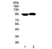 Western blot testing of Prolactin Receptor antibody and Lane 1:  human HeLa;  2: human MCF-7 cell lysate. Expected molecular weight: 70-117 kDa depending on glcosylation level.