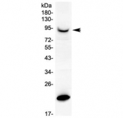 Western blot testing of rat PC-12 cell lysate with Prolactin Receptor antibody. Expected molecular weight: 70-117 kDa depending on glcosylation level.
