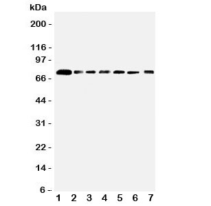 Western blot testing of SPARCL1 antibody and Lane 1: rat lung; 2: mouse lung; and human samples 3: PANC; 4: A549; 5: COLO320; 6: MCF-7; 7: HT1080 cell lysate. Predicted/observed size ~75KD