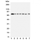 Western blot testing of SPARCL1 antibody and Lane 1: rat lung;  2: mouse lung; and human samples 3: PANC;  4: A549;  5: COLO320;  6: MCF-7;  7: HT1080 cell lysate.  Predicted/observed molecular weight ~75 kDa.