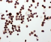 ICC testing of WISP1 antibody and human MCF-7 cells.