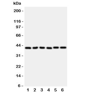 Western blot testing of WISP1 antibody and rat samples 1: heart; 2: kidney; 3: lung; and human samples 4: A549; 5: A431; 6: COLO320 cell lysate