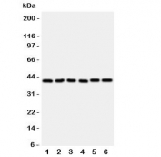 Western blot testing of rat 1) heart, 2) kidney, 3) lung and human 4) A549, 5) A431 and 6) COLO320 lysate with WISP1 antibody. Expected molecular weight: 40-55 kDa depending on degree of glycosylation.