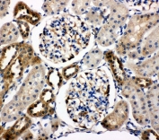 IHC staining of FFPE rat kidney tissue with WISP1 antibody. HIER: boil tissue sections in pH6, 10mM citrate buffer, for 10-20 min and allow to cool before testing.