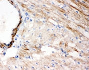 IHC staining of frozen rat heart tissue with WISP1 antibody.