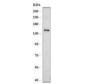 Western blot testing of ABCB4 antibody and MCF-7 cell lysate. Predicted molecular weight ~142 kDa.