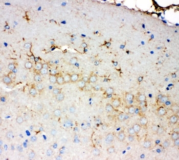 IHC-P: PMP70 antibody testing of rat brain tissue