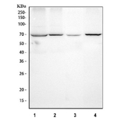 Western blot analysis of ABCD3 (PMP70) in 1) human 293T, 2) human HepG2, 3) rat liver and 4) mouse liver lysates using PMP70 antibody. A single band is detected at approximately 70 kDa in all samples, consistent with the reported apparent molecular weight of the 70 kDa peroxisomal membrane protein PMP70 (ABCD3) despite a theoretical mass of ~75 kDa.