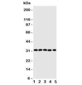 Western blot testing of Aquaporin 9 antibody and Lane 1: mouse liver; 2: (m) lung; 3: (m) spleen; 4: (m) testis; 5: rat PC-12 lysate. Predicted/observed size ~32KD