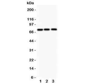 Western blot testing of APLP1 antibody and 1. human HeLa, 2. rat PC-12, 3. mouse Hepa1-6; Predicted/observed size ~72KD