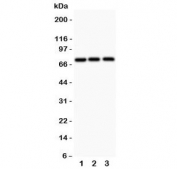 Western blot testing of APLP1 antibody and 1) human HeLa, 2) rat PC-12, and 3) mouse HEPA1-6 lysate;  Expected molecular weight: 76 kDa (unmodified), ~86 kDa (soluble/glycosylated form), 92~95 kDa (mature form).