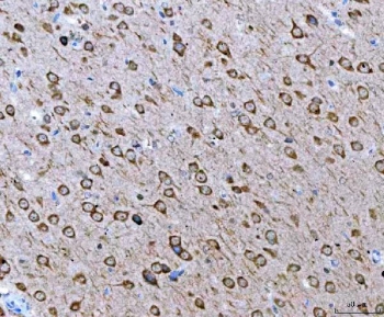 IHC staining of FFPE rat brain tissue with Ataxin-2 antibody. HIER: boil tissue sections in pH8 EDTA for 20 min and allow to cool before testing.
