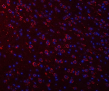 Immunofluorescent staining of FFPE mouse brain tissue with Ataxin-2 antibody (red) and DAPI nuclear stain (blue). HIER: steam section in pH8 EDTA buffer for 20 min.