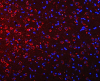 Immunofluorescent staining of FFPE rat brain tissue with Ataxin-2 antibody (red) and DAPI nuclear stain (blue). HIER: steam section in pH8 EDTA buffer for 20 min.