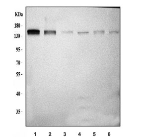 Western blot testing of 1) human K562, 2) human A549, 3) rat brain, 4) rat liver, 5) mouse brain and 6) mouse liver tissue lysate with Ataxin-2 antibody. Expected molecular weight: 114~140 kDa.