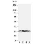 Western blot testing of BAG2 antibody;  Lane 1: rat testis;  2: HeLa;  3: A549;  4: A431 cell lysate.  Predicted/observed molecular weight: ~22kDa.