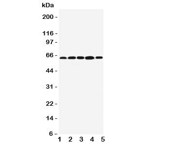 Western blot testing of BAG3 antibody; Lane 1: MCF-7; 2: Jurkat; 3: A549; 4: HeLa; 5: COLO320 cell lysate. Predicted/observed size ~62KD