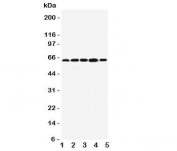 Western blot testing of BAG3 antibody;  Lane 1: MCF-7;  2: Jurkat;  3: A549;  4: HeLa;  5: COLO320 cell lysate.   Predicted molecular weight ~62kDa but can be observed at 75~80kDa.