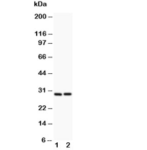 Western blot testing of Bcl2A1 antibody and (1) HeLa, (2) Jurkat lysate