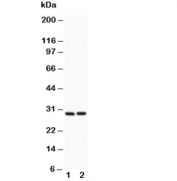 Western blot testing of Bcl2A1 antibody and (1) HeLa, (2) Jurkat lysate. Predicted molecular weight: ~20kDa but may be observed at up to ~37kDa.