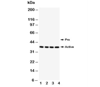 Western blot testing of Caspase-12 antibody; Lane 1: PANC; 2: SMMC-7721; 3: A549; 4: HeLa