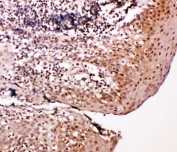 IHC-P: Caspase-14 antibody testing of human tonsil tissue