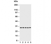 Western blot testing of Caspase-14 antibody;  Lane 1: rat brain;  2: rat liver;  3: rat spleen;  4: human A431;  5: mouse NIH3T3