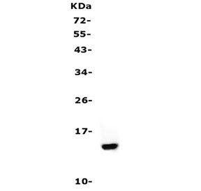 Western blot testing of Cystatin A antibody and human A431 cell lysate. Predicted molecular weight ~11 kDa.~