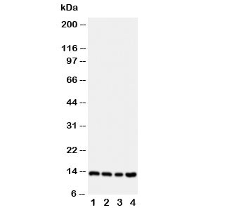 Western blot testing of Stefin B antibody; Lane 1: A549; 2: A431; 3: COLO320; 4: HeLa cell lysate~