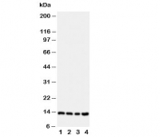 Western blot testing of Stefin B antibody;  Lane 1: A549;  2: A431;  3: COLO320;  4: HeLa cell lysate. Predicted/observed molecular weight: ~11kDa.