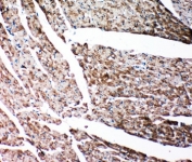 IHC-P: Gelsolin antibody testing of rat heart tissue. HIER: steamed with pH6 citrate buffer.