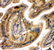 IHC staining of FFPE mouse intestine tissue with NFKB1 antibody. HIER: boil tissue sections in pH8 EDTA for 20 min and allow to cool before testing.