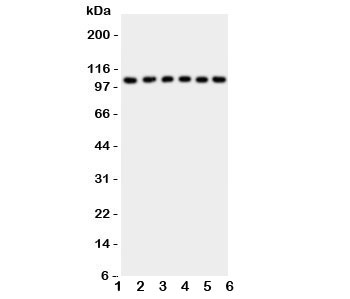 Western blot testing of NFKB1 antibody and Lane 1: rat liver; 2: (r) spleen; 3: (r) testis; 4: human HeLa; 5: (h) A431; 6: (h) Jurkat cell lysate. Expected size 50/105KD depending on sample