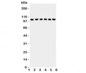Western blot testing of NFKB1 antibody and Lane 1:  rat liver;  2: (r) spleen;  3: (r) testis;  4: human HeLa;  5: (h) A431;  6: (h) Jurkat cell lysate. Expected molecular weight: 50 kDa / 105 kDa.