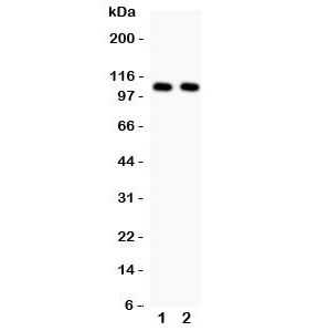 Western blot testing of NFKB1 antibody and 1. HeLa and 2. Jurkat cell lysate. Predicted/observed sizes 50/105KD depending on sample