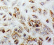 ICC testing of SMAD1 antibody and A549 cells
