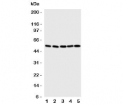 Western blot testing of SMAD5 antibody and Lane 1: human K562;  2: (h) Jurkat;  3: rat PC-12;  4: (h) HeLa;  5: (h) SMMC-7721 cell lysate.  Observed molecular weight: 52~60 kDa.