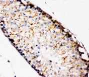 IHC-P: TBK1 antibody testing of rat testis tissue. HIER: steamed with pH6 citrate buffer.