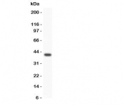 Western blot testing of WNT3A antibody and SMMC-7721 lysate.  Expected/observed size 35~44KD depending on glycosylation level.