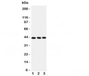 Western blot testing of CCR9 antibody and Lane 1:  Jurkat;  2: HeLa;  3: SMMC-7721 cell lysate.  Expected/observed size ~43KD