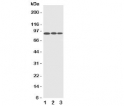 Western blot testing of CDC5L antibody and Lane 1:  HeLa;  2: Raji;  3: A549 cell lysate.  Predicted/observed size ~88KD