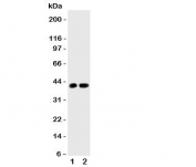 Western blot testing of Cdk6 antibody and Lane 1:  rat testis;  2: (r) lung tissue lysate.  Predicted molecular weight: 36-40 kDa.