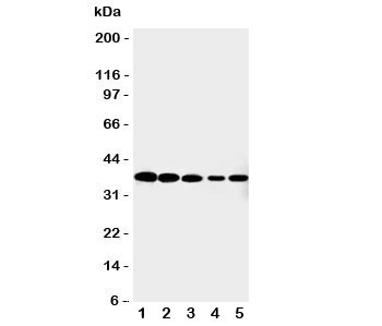 Western blot testing of Cdk7 antibody and Lane 1: HeLa; 2: MCF-7; 3: A549; 4: COLO320; 5: Jurkat cell lysate. Expected/observed size ~37KD~